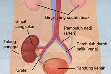 Pemicu Kandung Kemih Sakit